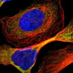 ADNP2 Antibody, Novus Biologicals:Antibodies:Primary Antibodies